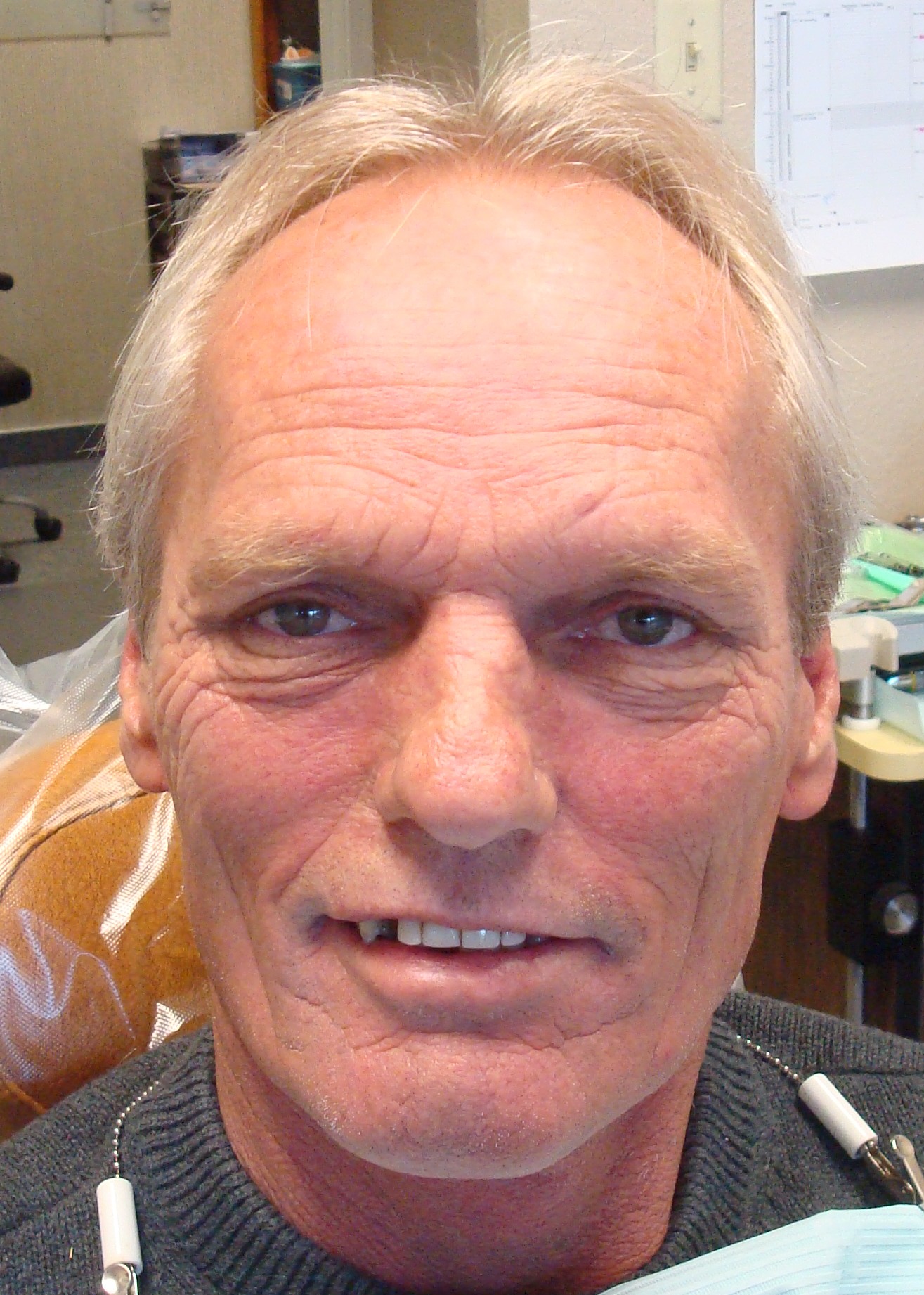 Smile Gallery Fair Oaks, CA Dr. Brian Orcutt